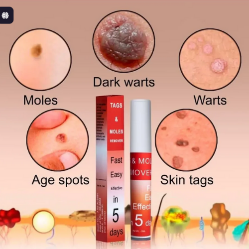 DermaCare™ Skin Spot Care Cream I Gentle care. Confident skin.