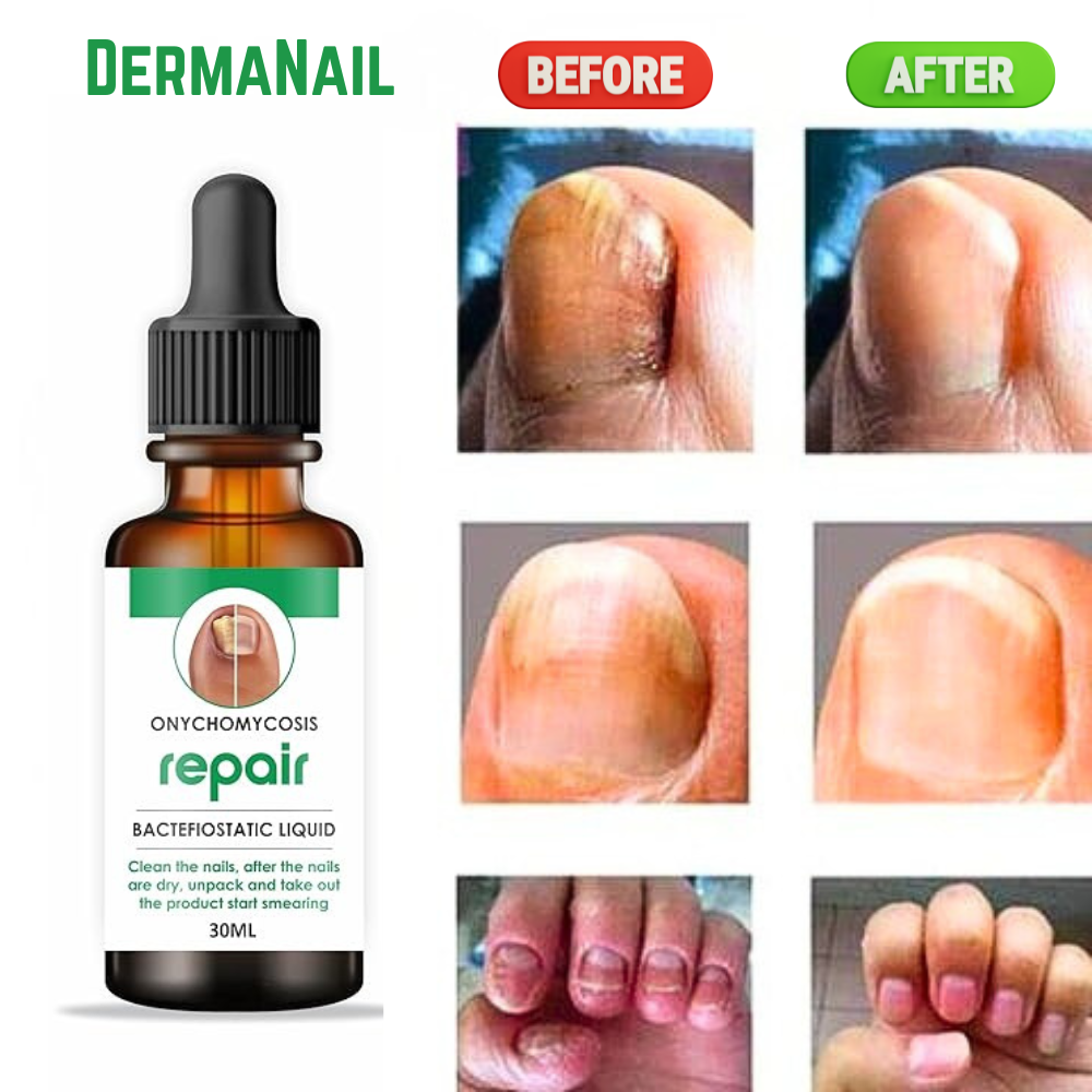 DermaNail™ I Nail Restore Oil