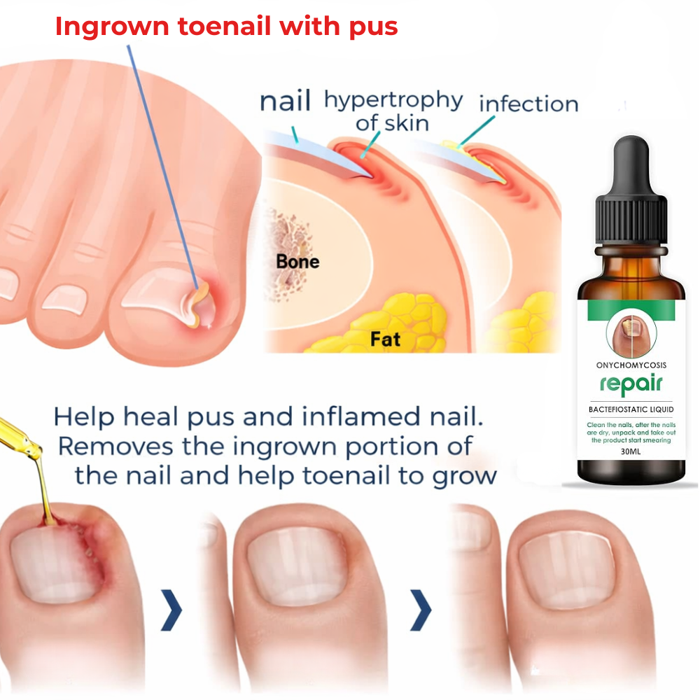 DermaNail™ I Nail Restore Oil